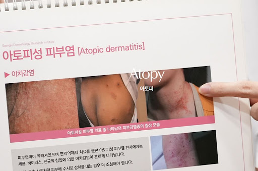 생기한의원 아토피 페이지에서 다루는 색소침착 피부 변화